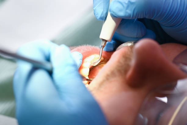 Best Urgent Tooth Repair  in Ferrysburg, MI