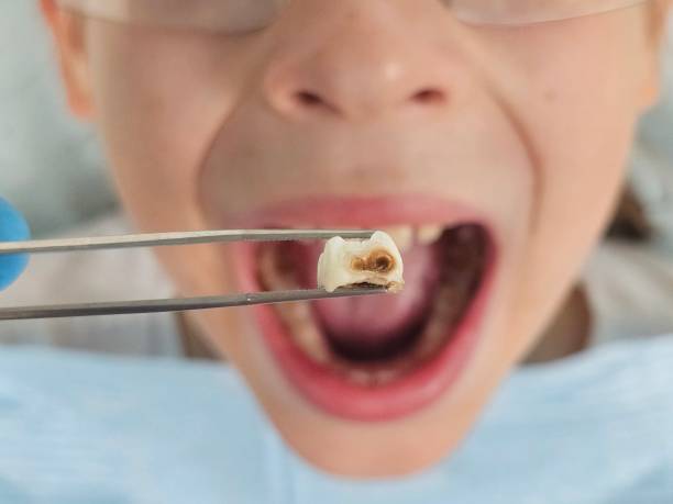 Best Emergency Dentist for Kids  in Ferrysburg, MI