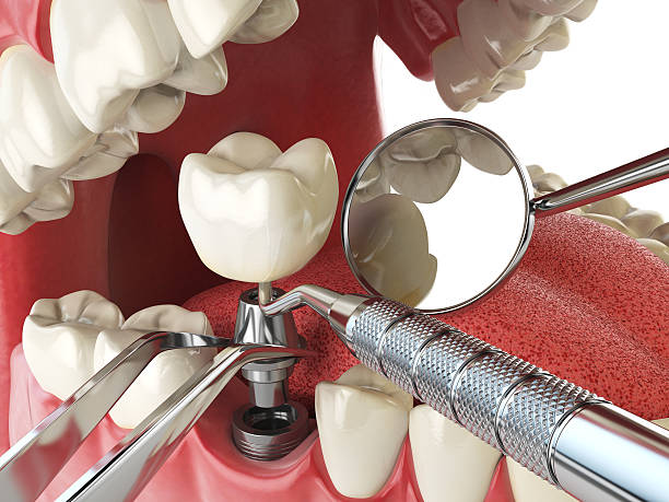 Emergency Gum Pain Relief in MI